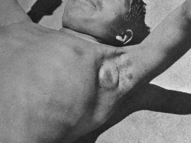 Madagaskar mit Notfallplan gegen Pest — Bild: Otis Historical Archives of "National Museum of Health & Medicine" / Wikimedia(CC-BY-2.0)