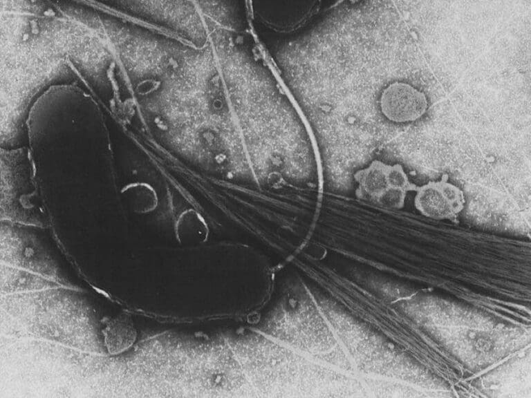 Cholera-Epidemie: Im Jemen bereits 115 Tote und 8500 Verdachtsfälle — Bild: Tom Kirn, Ron Taylor, Louisa Howard - Dartmouth Electron Microscope Facility / Wikimedia (PD)